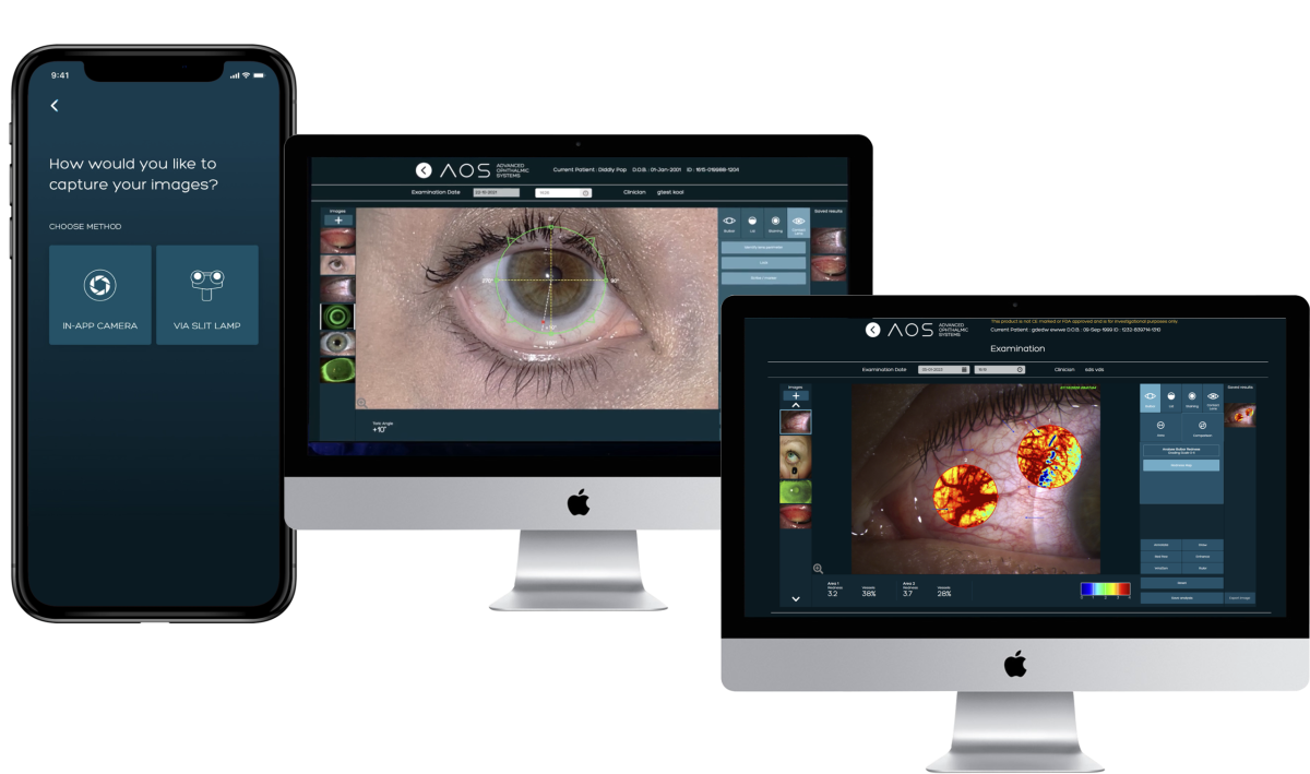 Image shows product developed on Camgenium's platform. Photos of eyes are taken by the patient at home and transferred to the clinician who analyses them using automatic routines.